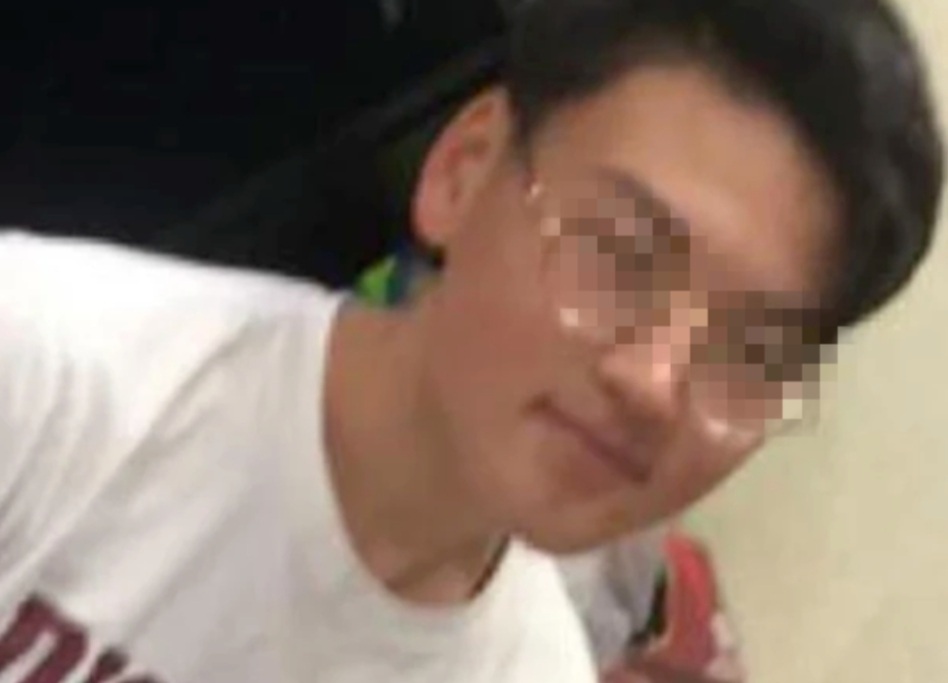 17, 国王福克斯韧带撕裂  
